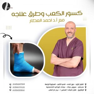كسور الكعب وطرق العلاج