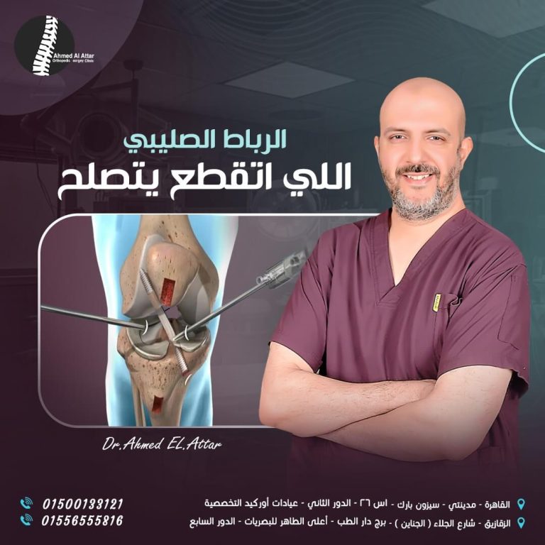 الرباط الصليبي الامامي