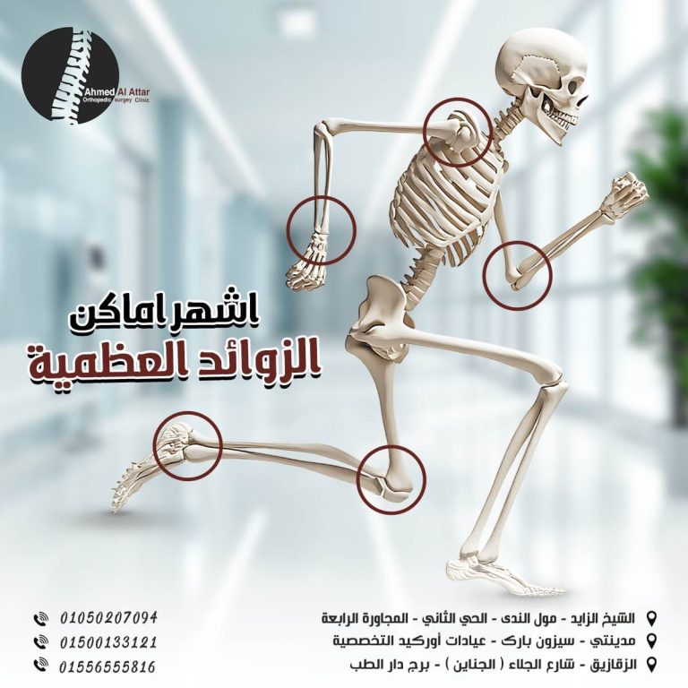 الزوائد العظمية