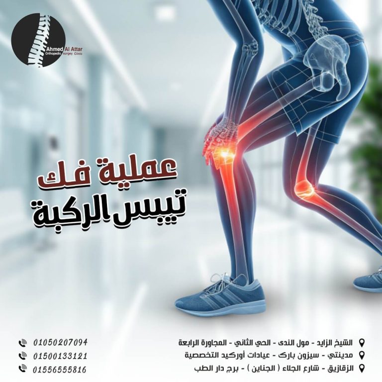 عملية فك تيبس الركبة