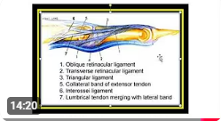 Extensor apparatus of the hand (arabic)