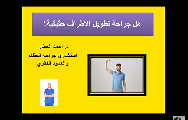 هل جراحة تطويل الأطراف حقيقية؟