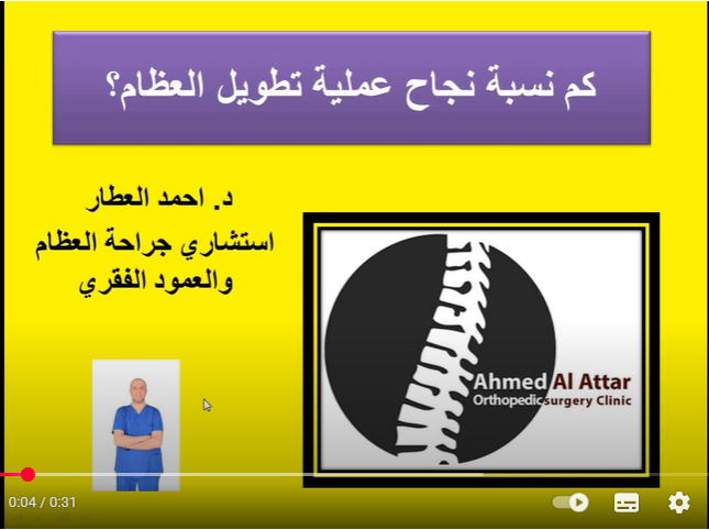 كم نسبة نجاح عملية تطويل العظام؟