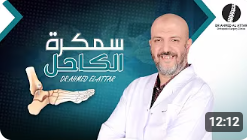 سمكرة الكاحل بالتفصيل للدكتور احمد العطار