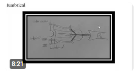 extensor appratus of the finger (english)