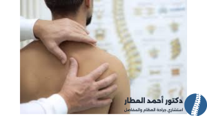 نسبة نجاح عملية منظار الكتف