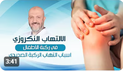 اسباب التهاب الركبة الصديدي | لا تتجاهل هذه الأعراض الخطيرة في ركبة طفلك