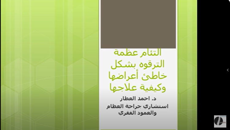 Title💥 عظمة الترقوة لو لحمت غلط ممكن تسببلك آلام مزمنة وتشوه وشلل في الحركة وانت مش واخد بالك!"