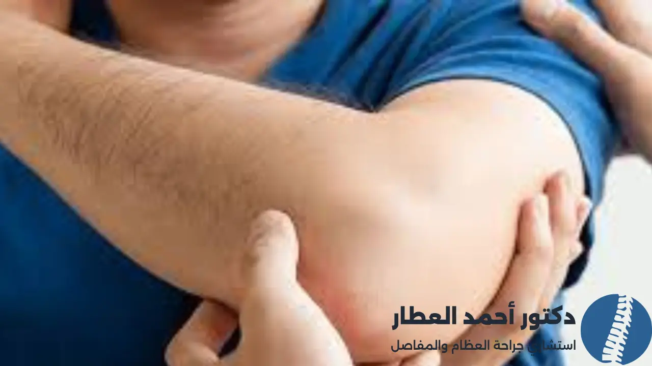 علاج خلع الكتف