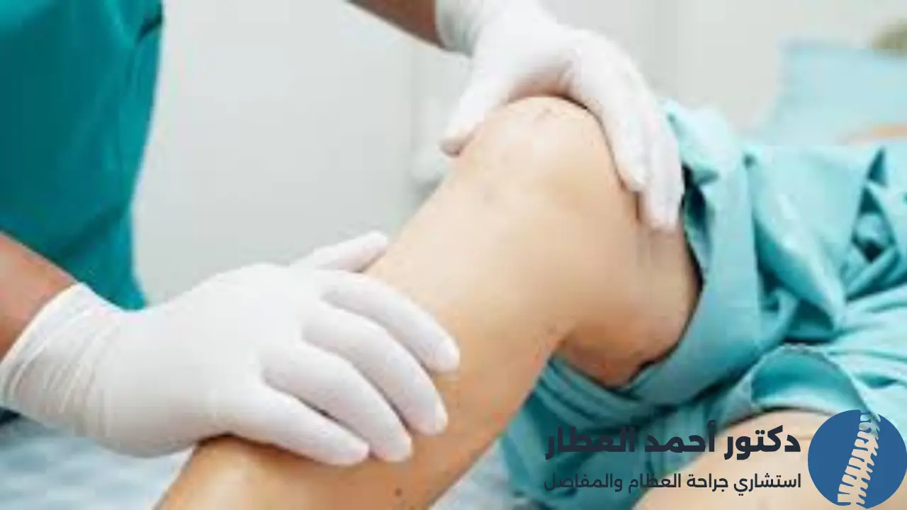 عملية تغيير مفصل الركبة مع دكتور احمد العطار