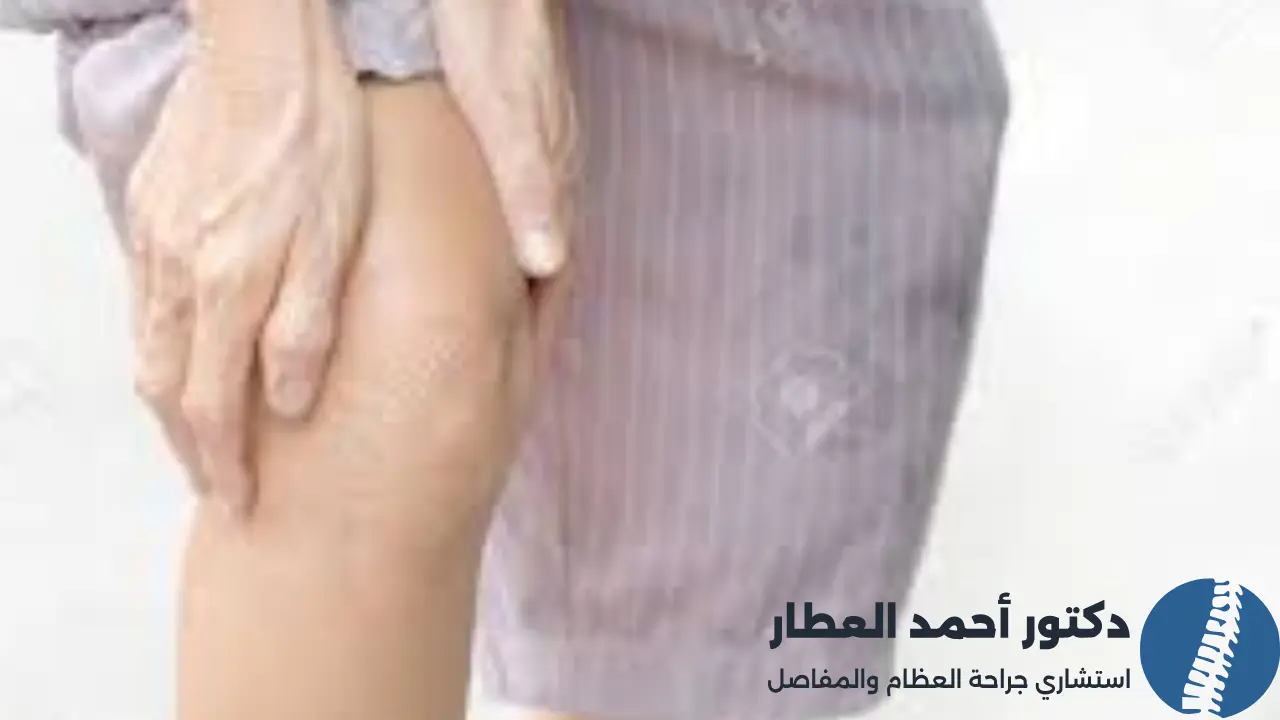 عملية منظار الركبة