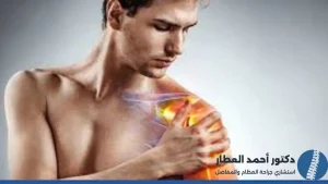 عملية منظار الكتف دليل شامل