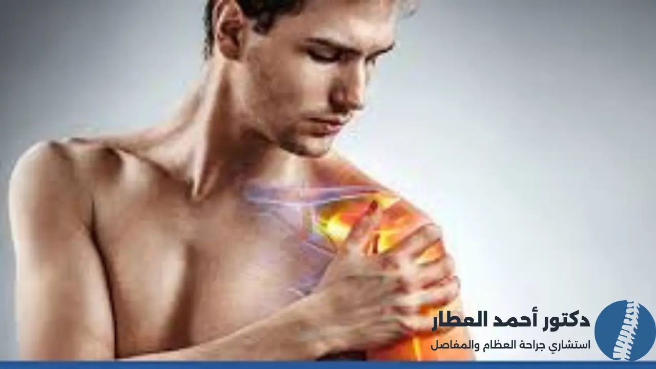 عملية منظار الكتف دليل شامل