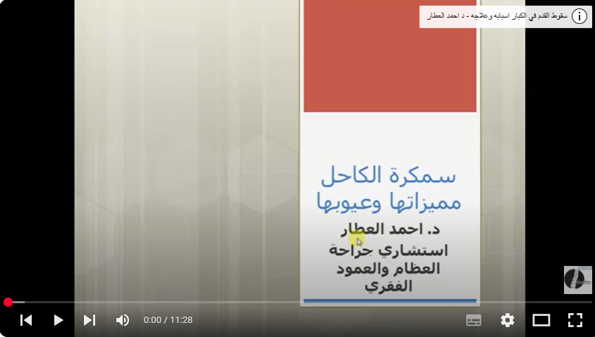 سمكرة الكاحل مميزاتها وعيوبها - د احمد العطار