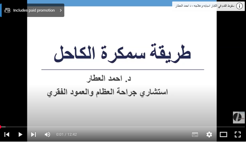 طريقة سمكرة الكاحل د احمد العطار