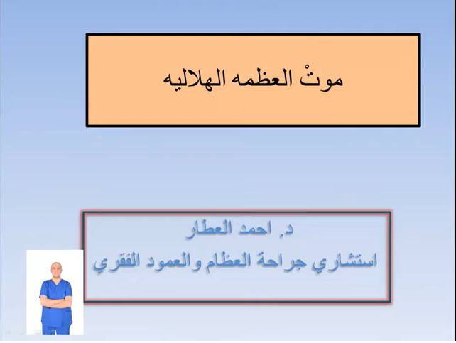 المْ الرسغ (موت العظمه الهلاليه) للدكتور احمد العطار