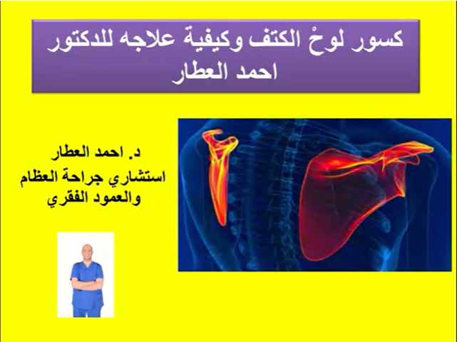 كسور لوحْ الكتف وكيفية علاجه للدكتور احمد العطار