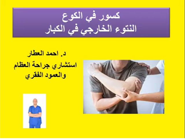 كسور في الكوع - النتوء الخارجي في الكبار للدكتور احمد العطار