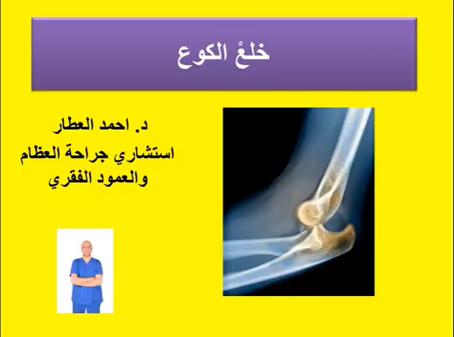 خلعْ الكوع الاسباب والعلاج للدكتور احمد العطار