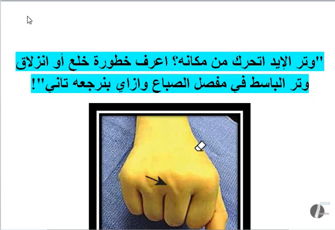 وتر الإيد اتحرك من مكانه؟ اعرف خطورة خلع أو انزلاق وتر الباسط في مفصل الصباع وازاي بنرجعه تاني!