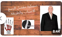 سمكرة مفصل الرسغ الاسباب والطريقه للدكتور احمد العطار