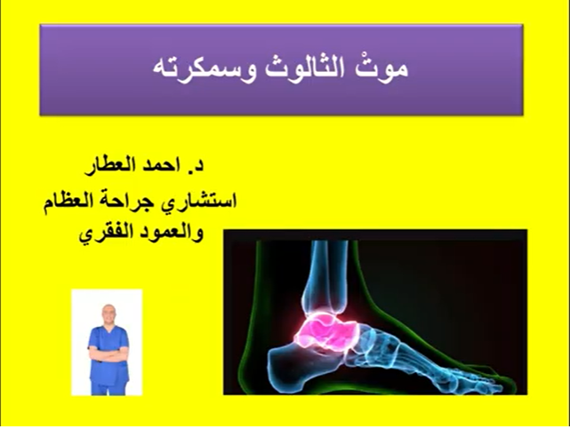 موتْ الثالوث وسمكرته للدكتور احمد العطار