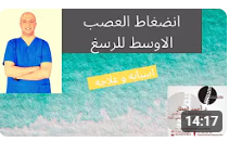 انضغاط العصب الاوسط للرسغ اسبابه و علاجه للدكتور احمد العطار