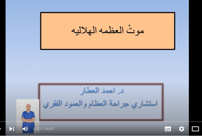موتْ العظمه الهلاليه - طريقة التفكير للدكتور احمد العطار