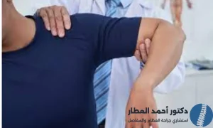 خلع الكتف