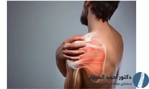 خلع الكتف المتكرر