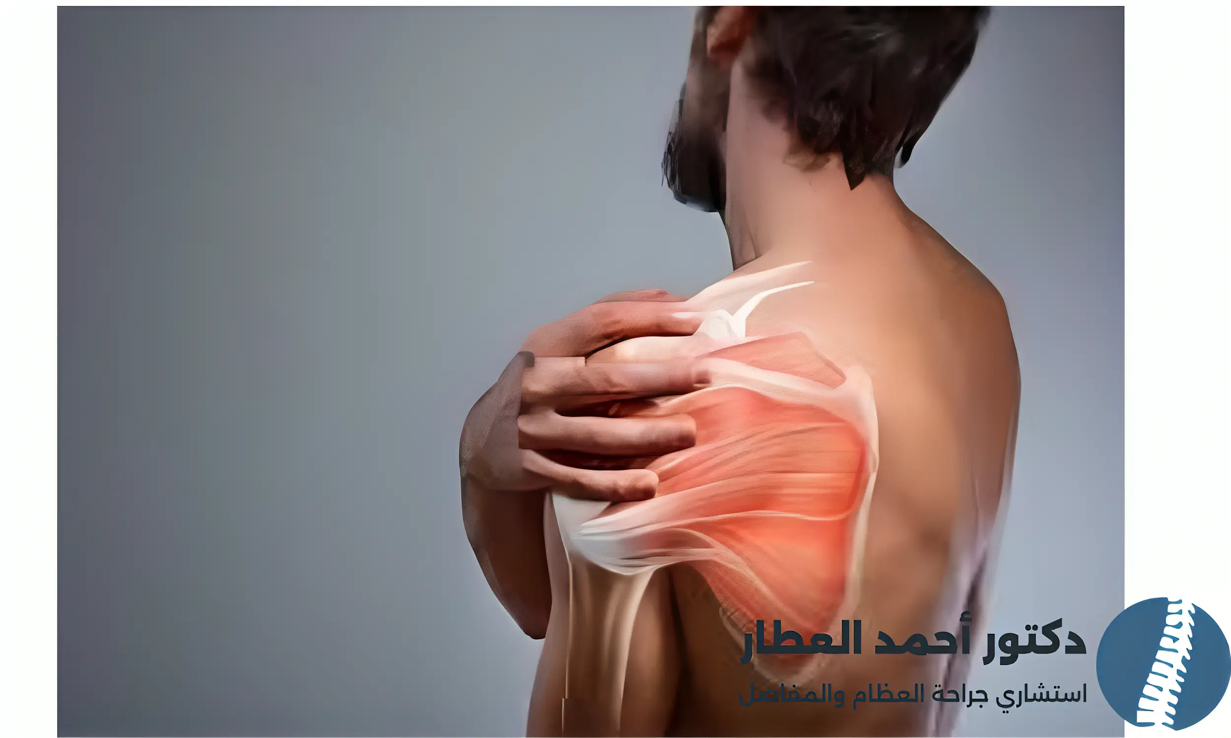 خلع الكتف المتكرر