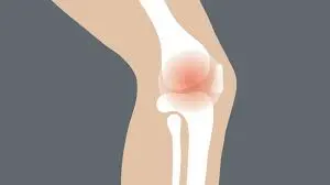 علاج ألم في الركبة عند ثنيها وفردها
