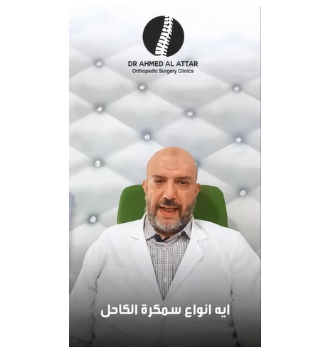 انواع سمكرة الكاحل 