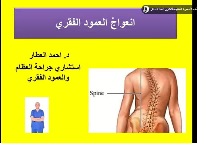 انعواجْ العمود الفقري الاسباب وطرق العلاج للدكتور احمد العطار
