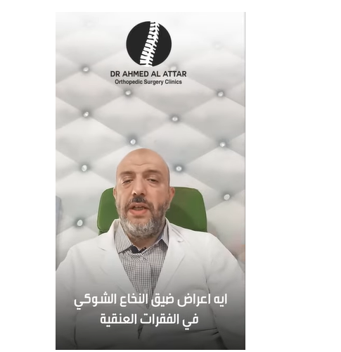 اعراض ضيق النخاع الشوكي في الفقرات العنقية