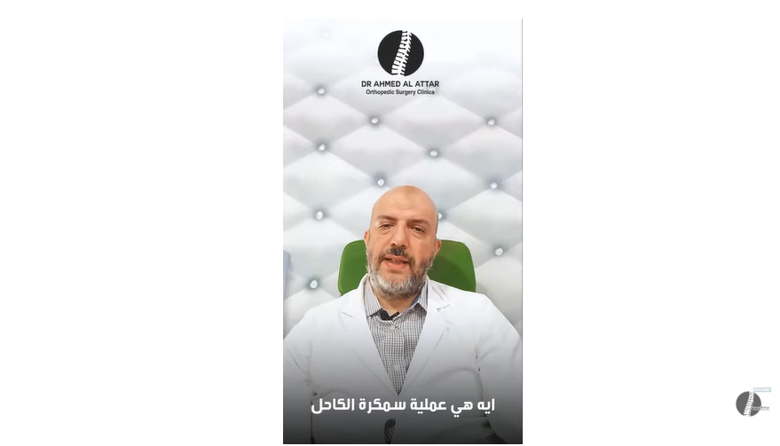 ايه هي عملية سمكرة الكاحل ؟