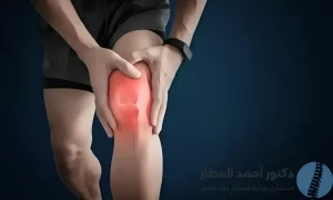 علاج ألم في الركبة عند ثنيها وفردها