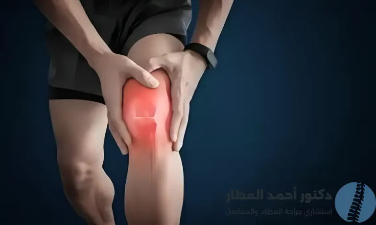 علاج ألم في الركبة عند ثنيها وفردها