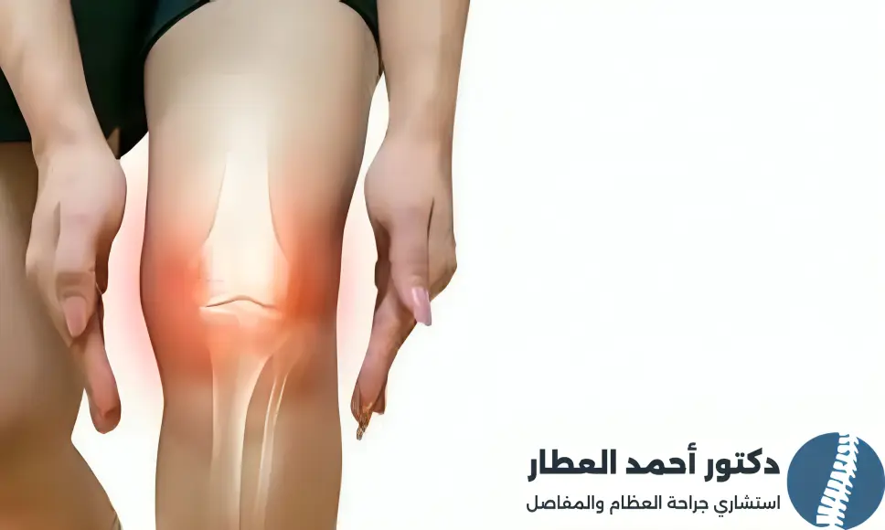 هل يمكن التعايش مع قطع غضروف الركبة
