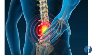 أعراض الانزلاق الغضروفي القطني