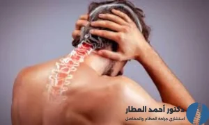 اعراض غضروف الرقبة وعلاجه