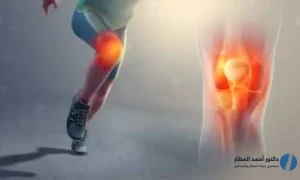 افضل دكتور إصابات ملاعب في مصر
