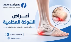 اعراض الشوكة العظمية