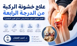 علاج خشونة الركبة من الدرجة الرابعة