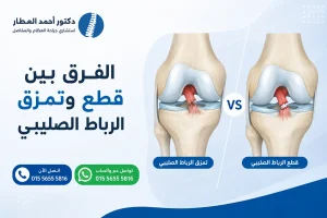 الفرق بين قطع وتمزق الرباط الصليبي