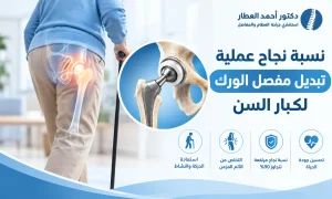 نسبة نجاح عملية تبديل مفصل الورك لكبار السن